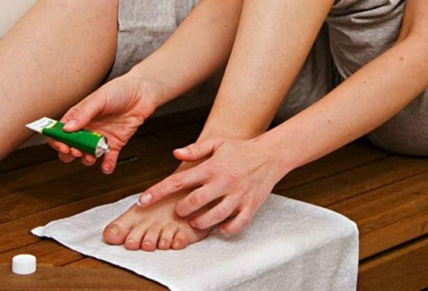Nakładanie maści przeciwgrzybiczej na stopy w celu leczenia grzybicy