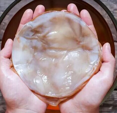 Kombucha na grzybicę paznokci